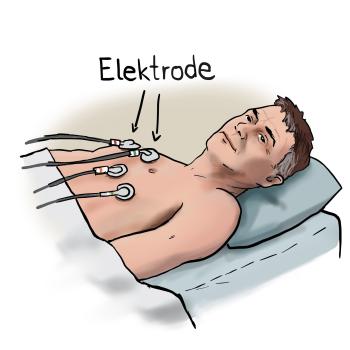 Elektrode